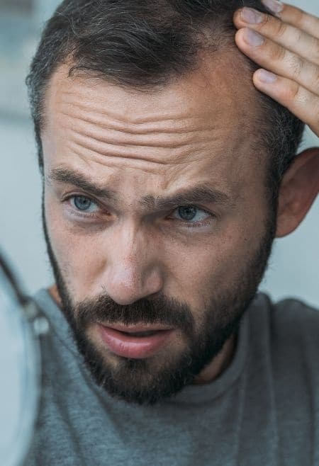 hair loss