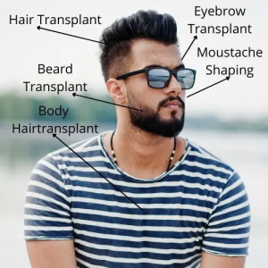 Types of Hair Transplant